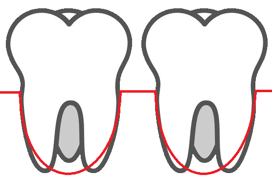 Imatge de periodòncia a la Clínica Dental Oíza-Colera